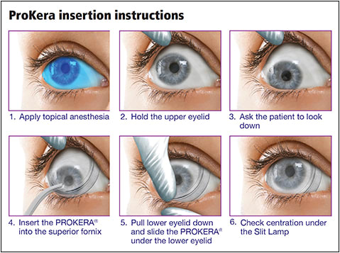 Woman being fitted for new eyeglasses